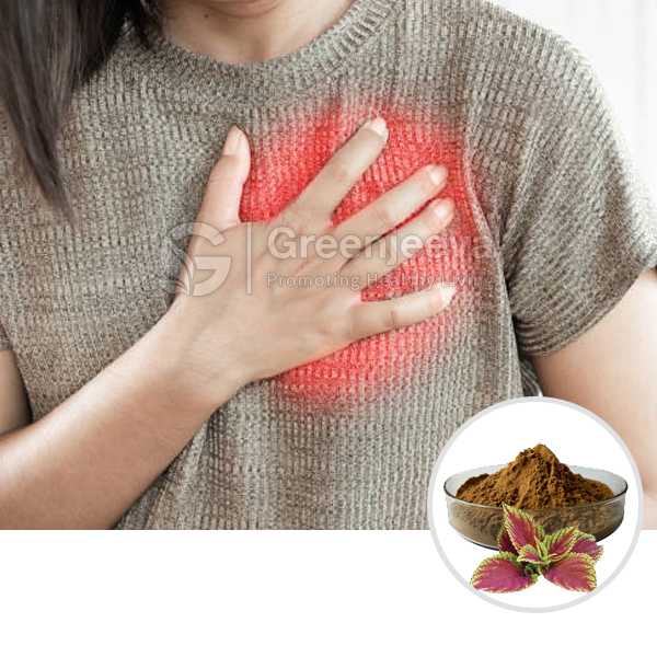 Coleus Forskohlii Extract Powder 10%  Forskolin, HPLC
